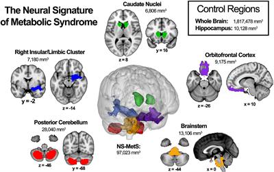 Frontiers | Metabolic syndrome predictors of brain gray matter